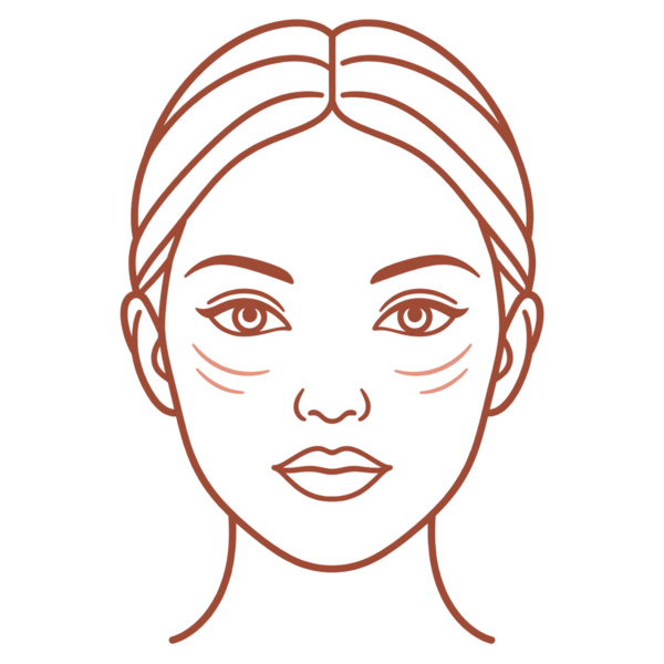 Illustration of a face marking the eye area for Thermage FLX skin tightening in London