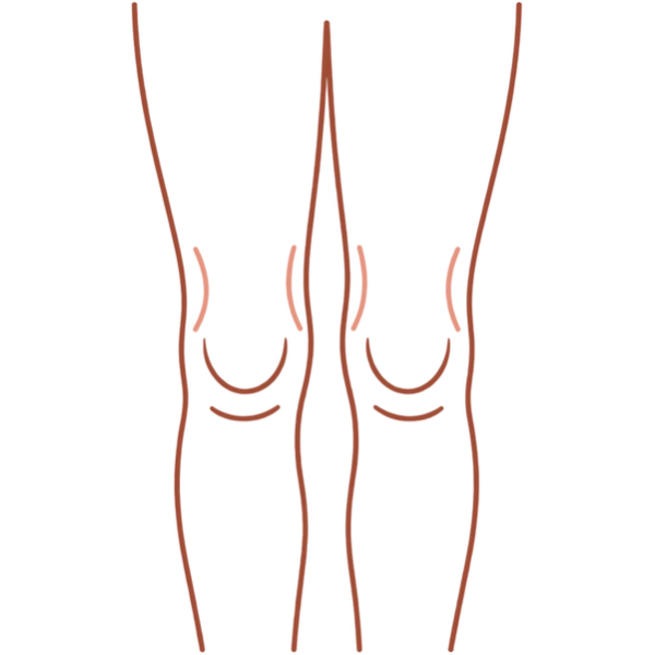 Illustration of legs marking the knees and thighs for Thermage FLX skin tightening in London